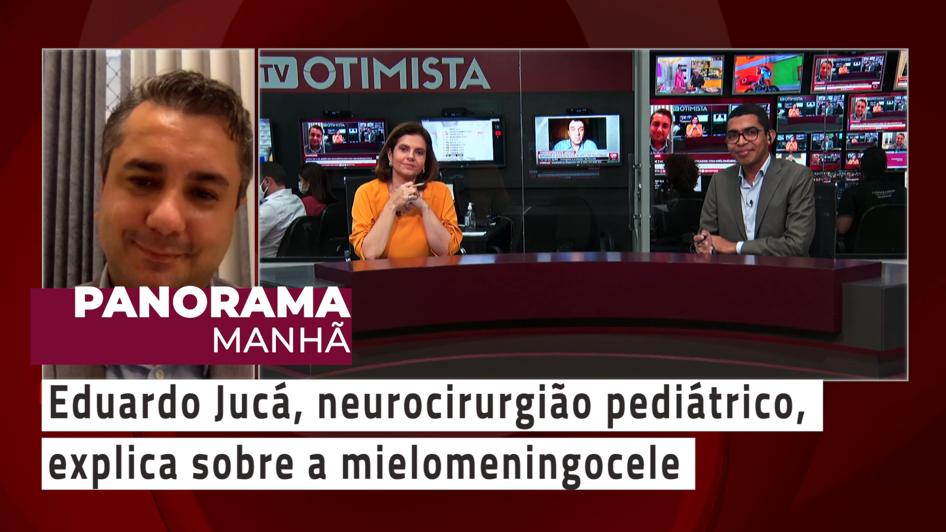 Panorama Manhã – Eduardo jucá, neurocirurgião pediatrico, explica sobre a mielomeningocele