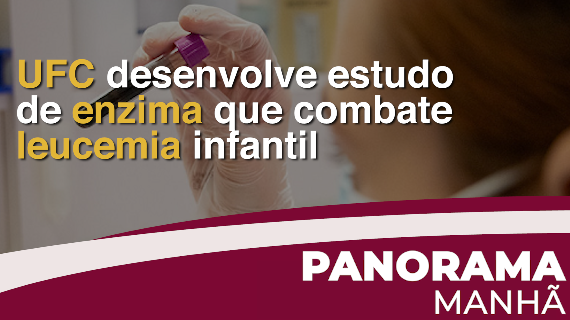 Pesquisadores da UFC estudam papel de enzima da imortalidade celular na leucemia aguda infantil