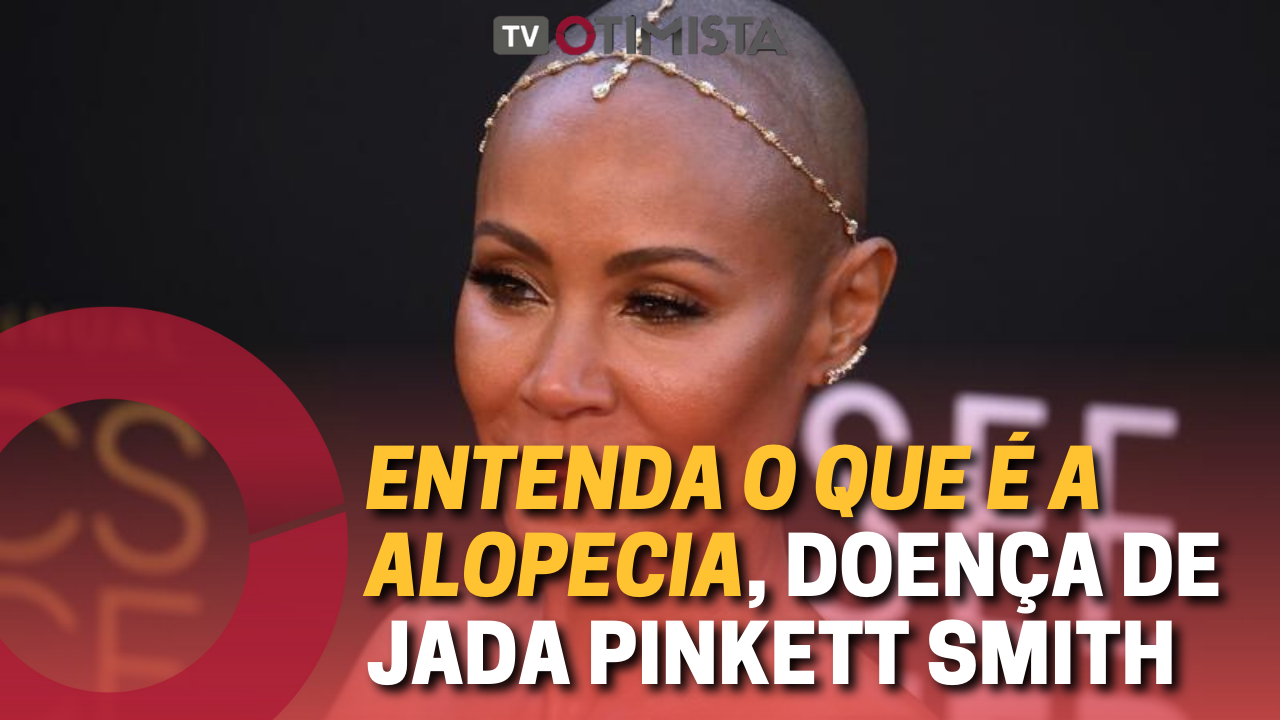 Entenda o que é a alopecia, doença de Jada Pinkett Smith